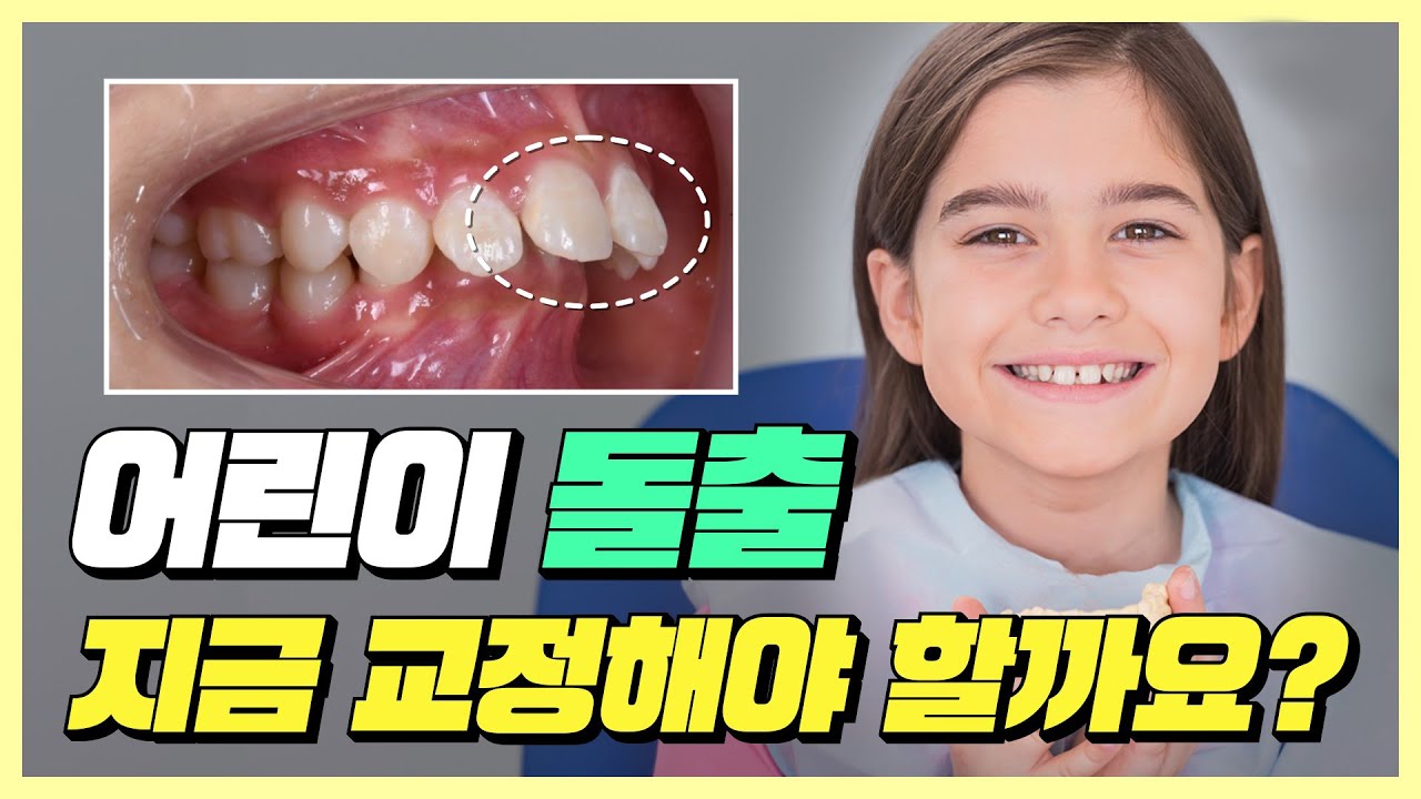 어린이 돌출 지금 교정해야할까요?
