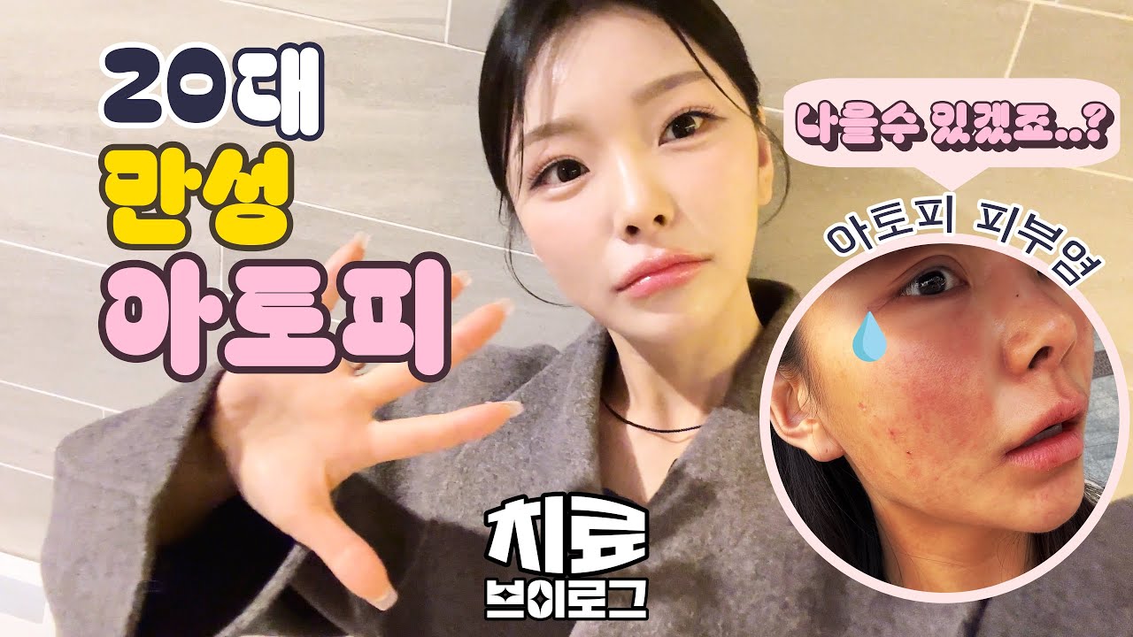 불치병 극복일기 2N년차 아토피랑 싸우는 둥 (feat. 아토피병원, 실비처방, ldm관리,물광에스테틱, 아토피크림추천,더마코스메틱,셀퓨전씨크림)