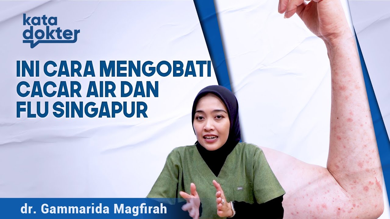 Cacar Air dan Flu Singapur, Apa Bedanya? | Kata Dokter