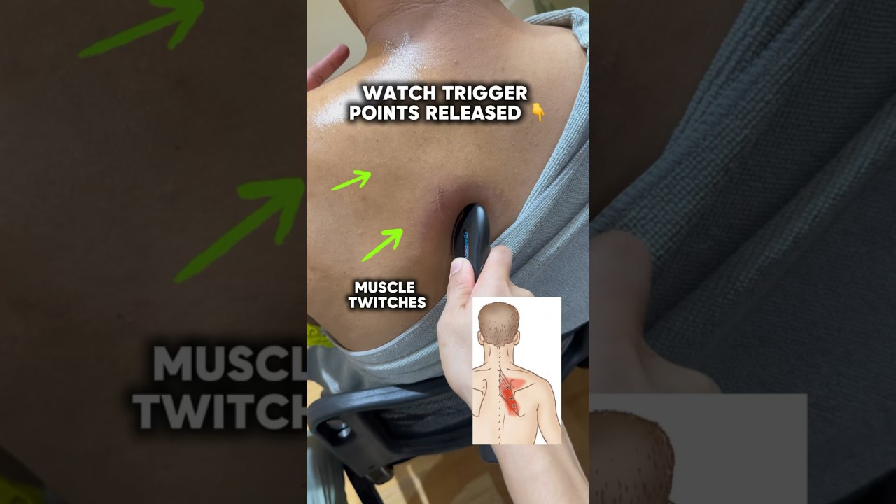 WHAT YOUR RHOMBOID PAIN IS LOOKING FOR 🤩🤩🤩 #rhomboids #scapularpain #backpain #viralvideo