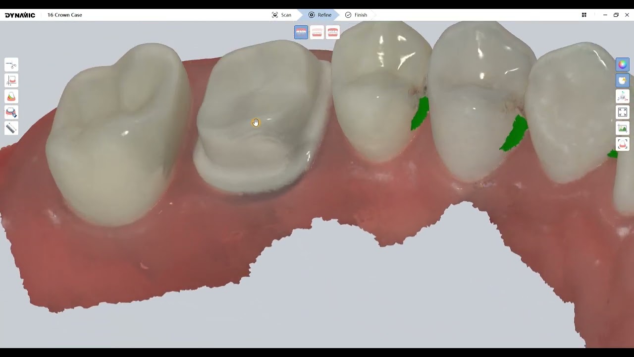 DDS500 restoration workflow