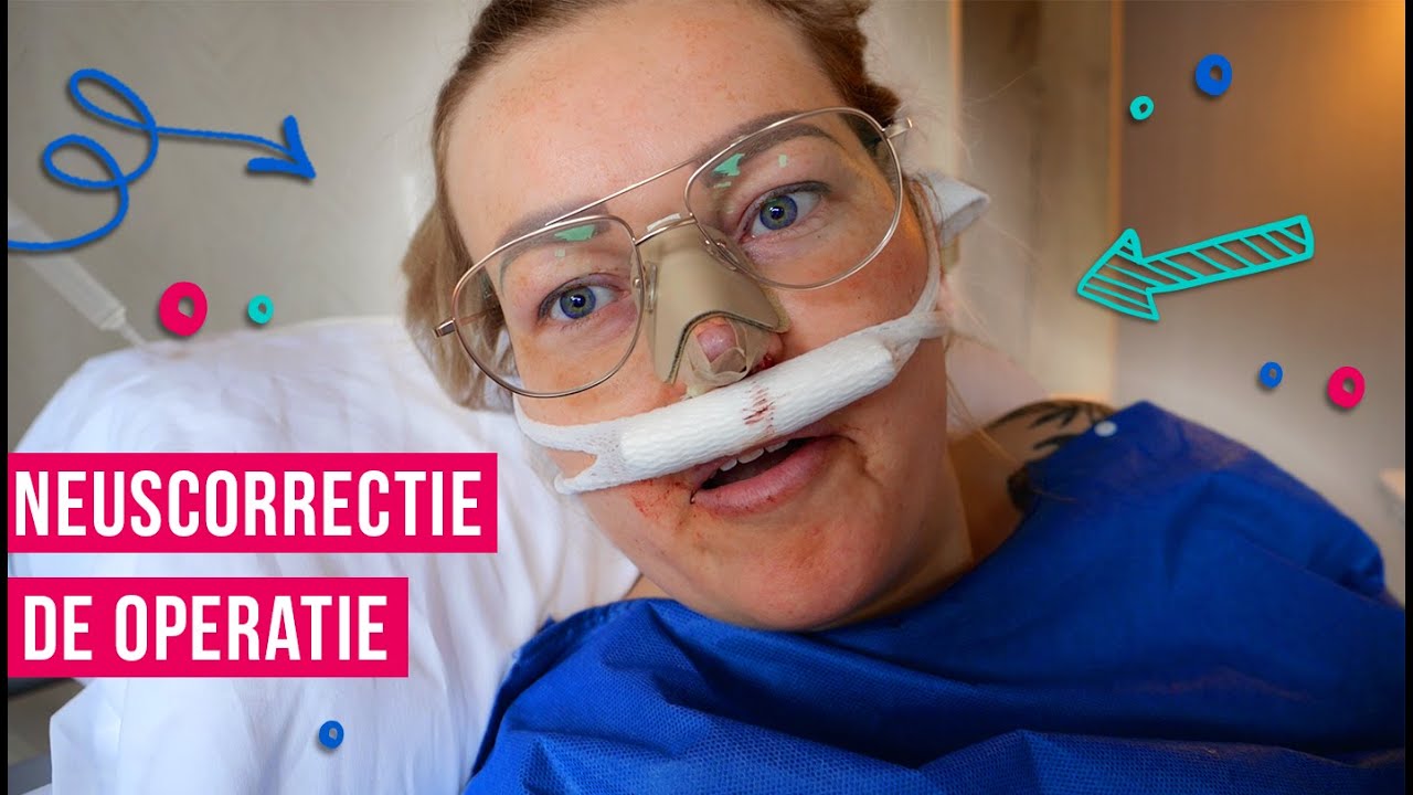 Neuscorrectie: DE OPERATIE!!! Mijn volledige neuscorrectie bij Bergman (BEY)
