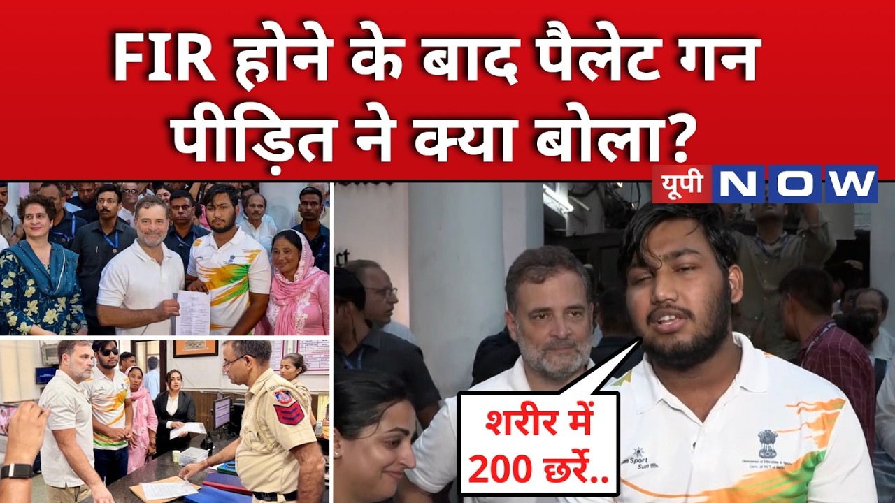 Pellet Gun Case : छर्रों से जख्मी छात्र Sahil ने FIR दर्ज होते ही सुनाई दास्तान ! Top News |