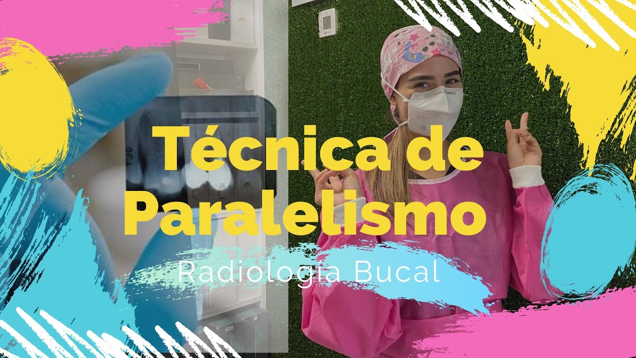 Técnica de Paralelismo | Radiología Bucal