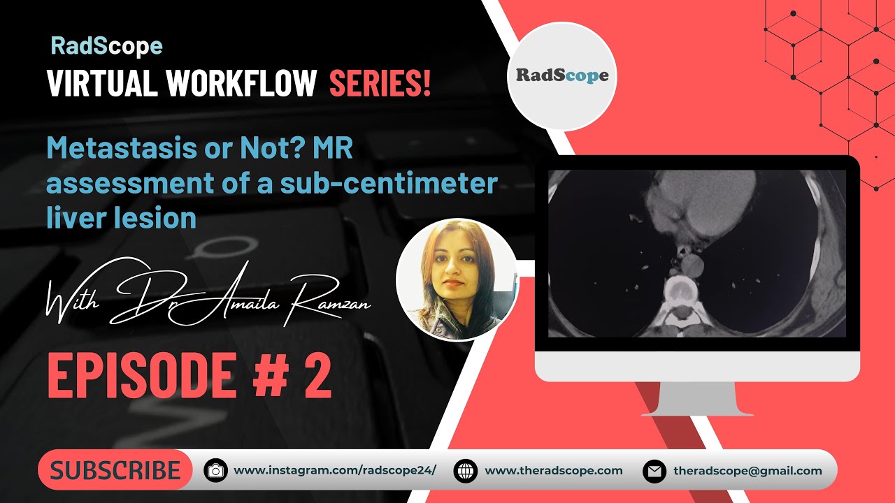 Metastasis or Not, MR assessment of a subcentimeter liver lesion