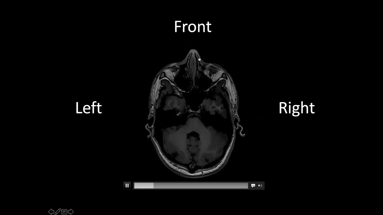 Brain Awareness Month 2021: Nelson