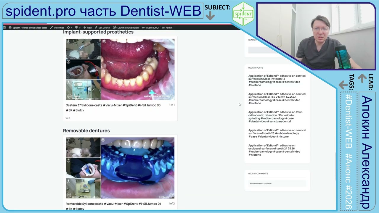 АНОНС - spident.pro 24 клинических примера бесплатно -2026 #rubberdamology #DentistWEB - Часть 17 4K