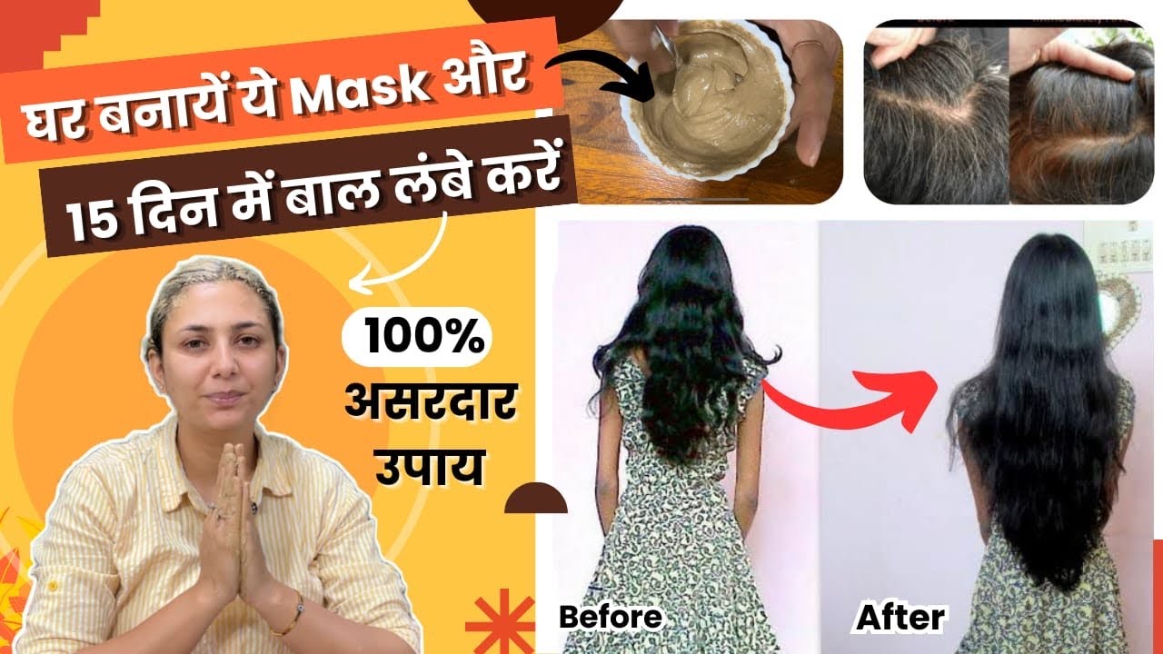 बाल लंबे करें 15 दिन में - Moti Choti | DIY Hair Growth Homemade Mask | Upasana Ki Duniya