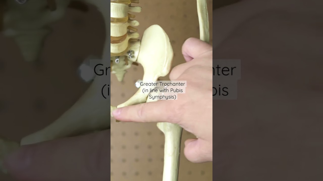 Intramuscular Injection - Ventrogluteal Muscle (Skeleton Edition)