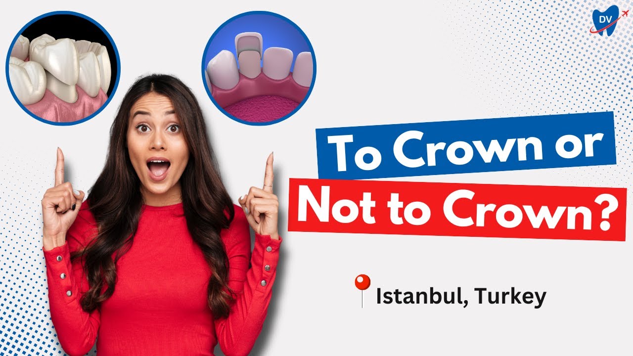 What&rsquo;s Best for You: Dental Crowns or Veneers in Istanbul, Turkey?