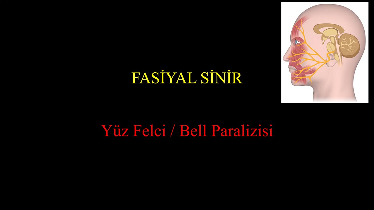 Yüz Felci (Fasiyal Paralizi)
