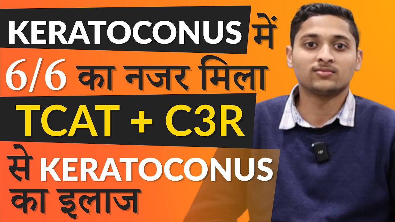 Keratoconus - Latest Treatment | T-CAT + C3R | केरेटोकोनस के लेटेस्ट इलाज से 6/6 की नज़र मिली