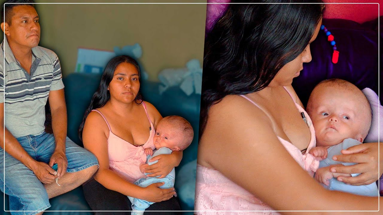 Así es vivir con hidrocefalia en México