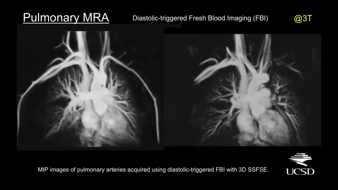Multimodality Vascular Imaging: From Head to Toe - Course Sample