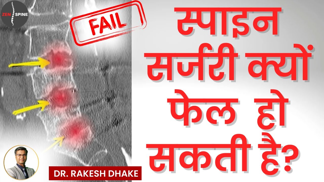 स्पाइन सर्जरी फेल क्यों हो सकती है? Failed Back Surgery