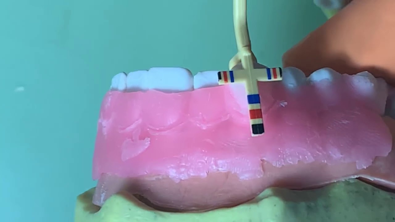 Uso de sonda de Chu