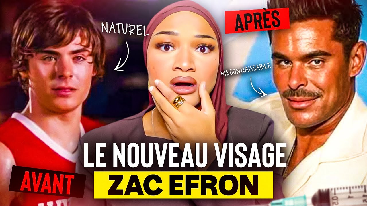 ZAC EFRON : SA TRANSFORMATION À CAUSE DE LA CHIRURGIE!!😱
