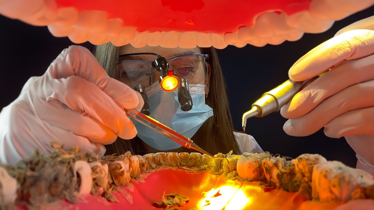 ASMR Dental Cleaning 🦷 Deep Teeth Cleaning & Check Up