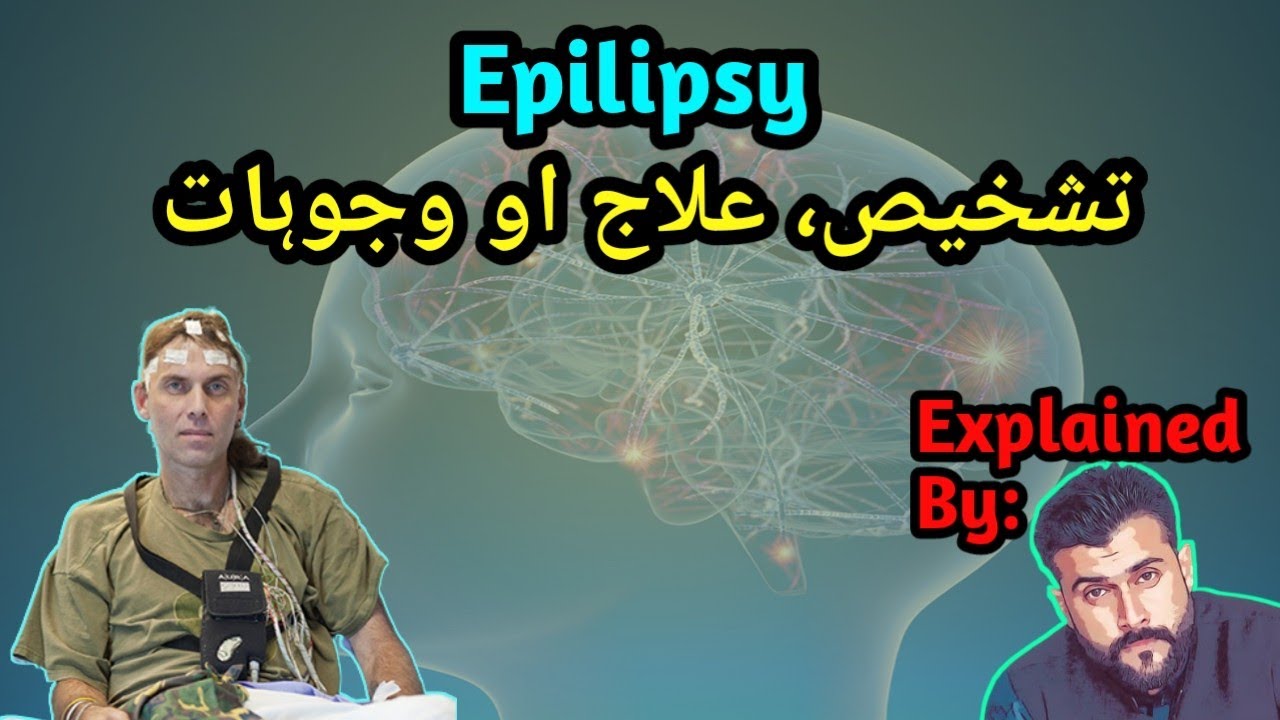 Epilipsy , causes , test and treatment explained by Tariq Pathan