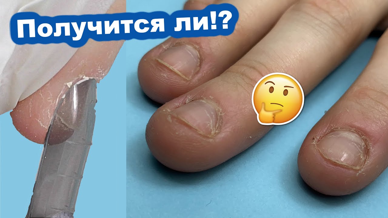 Верхние Формы для ОБКУСАННЫХ Ногтей - Получится ли!? Преображение ногтей - Маникюр и Наращивание