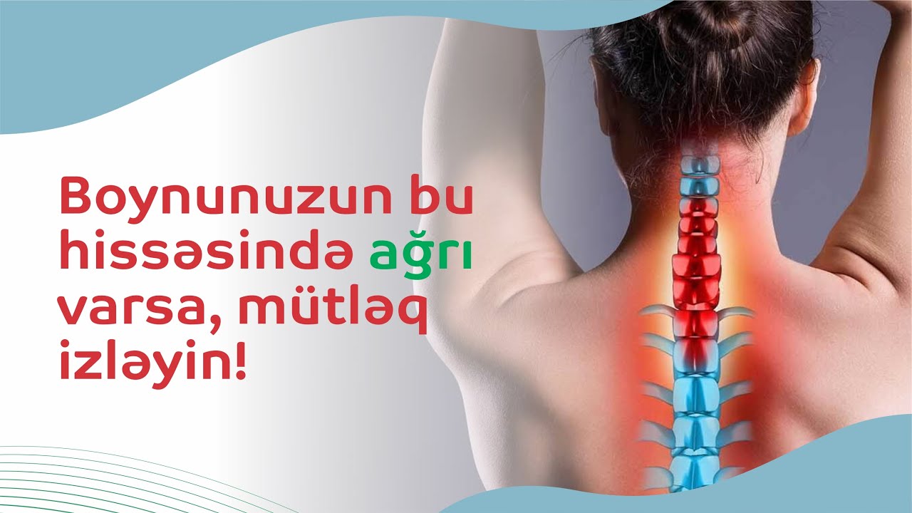 Boynunuzun bu hissəsində ağrı varsa, MÜTLƏQ İZLƏYİN ! #boyunağrısı #nevroloq