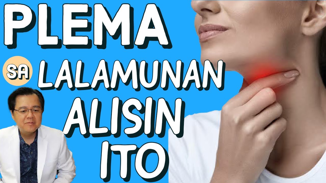 Plema sa Lalamunan: Alisin Ito - By Doc Willie Ong #1075