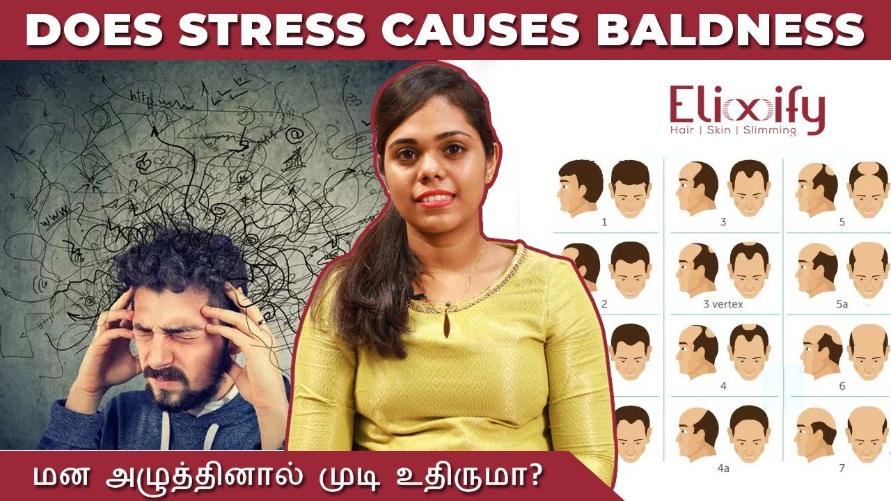 Does Stress Causes Baldness | மன அழுத்தினால் முடி உதிருமா ? | Elixify | Tamil