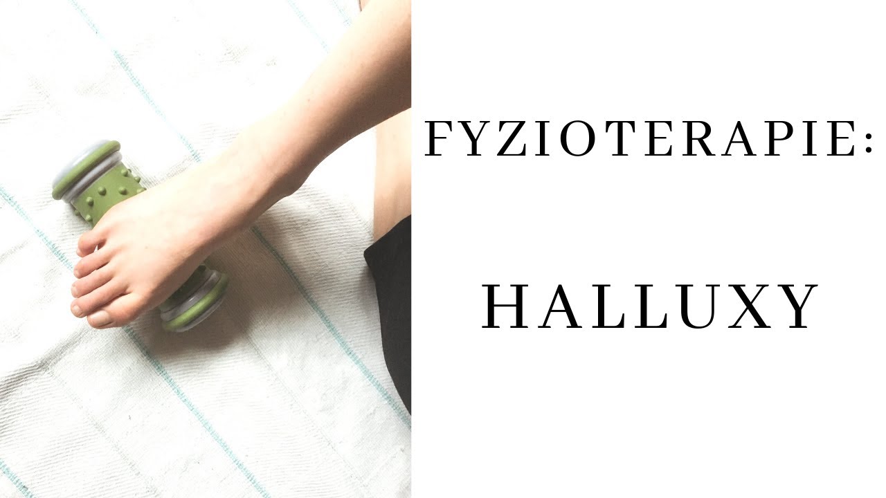 Vbočený palec, cviky, protažení, hallux valgus a fyzioterapie