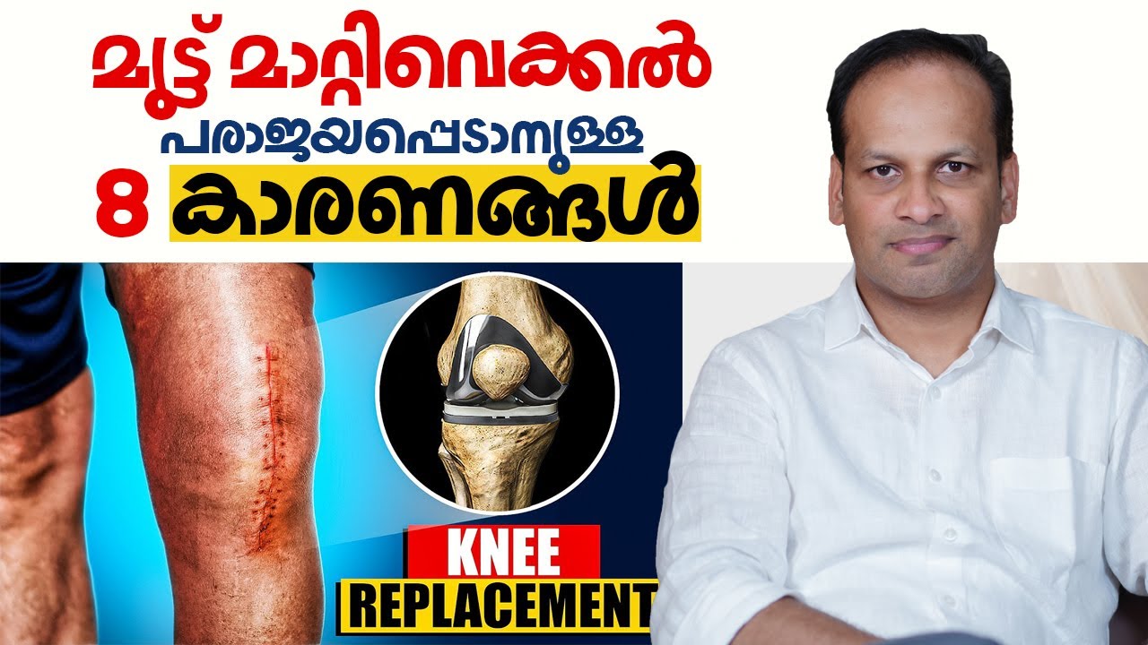 മുട്ട് മാറ്റിവെക്കൽ ശസ്ത്രക്രിയ പരാജയപ്പെടാനുള്ള 8 കാരണങ്ങൾ | Knee Replacement Surgery