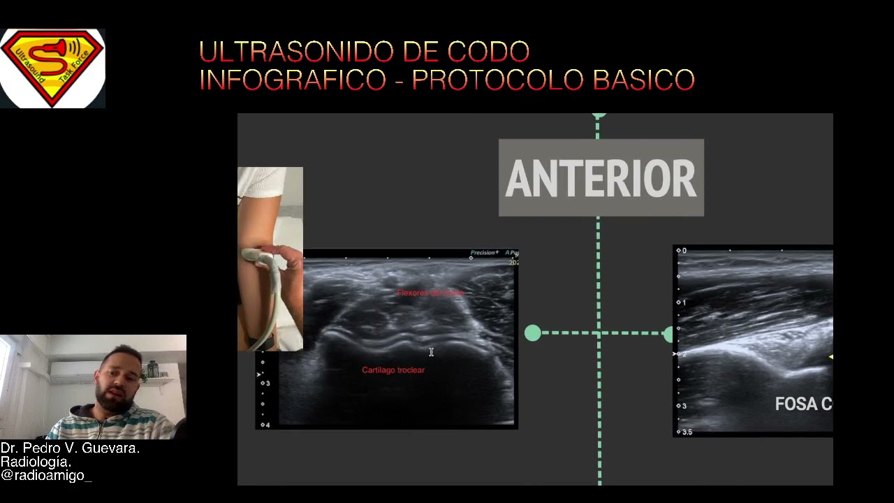 PROTOCOLO ECOGRAFICO CODO- INFOGRAFICO VIDEO