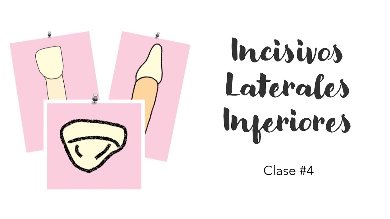 INCISIVOS LATERALES INFERIORES | ANATOMÍA DENTAL