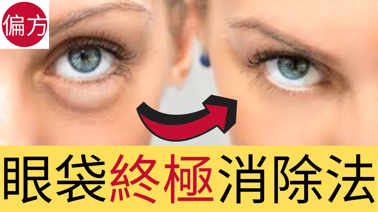 眼袋消除法｜兩個月徹底消除眼袋