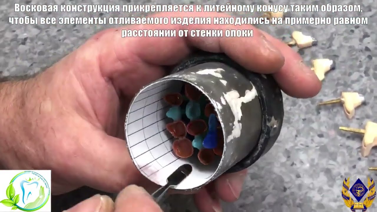 Лабораторные этапы изготовления литых ортопедических конструкций