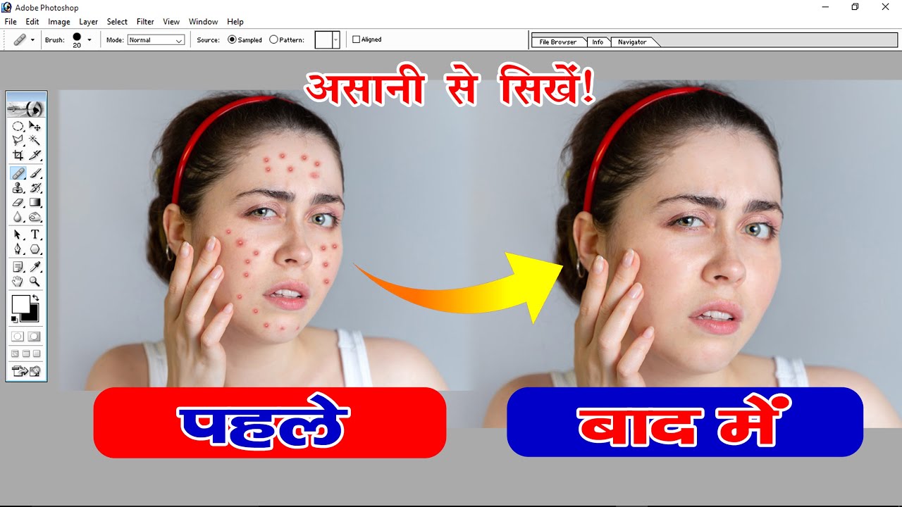 Photoshop Me Daag Dhabbe Kaise Hataye | फोटोशॉप में दाग धब्बे कैसे हटाये