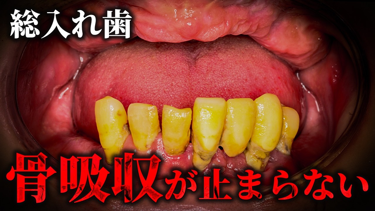 入れ歯の闇を全て経験したある患者の末路