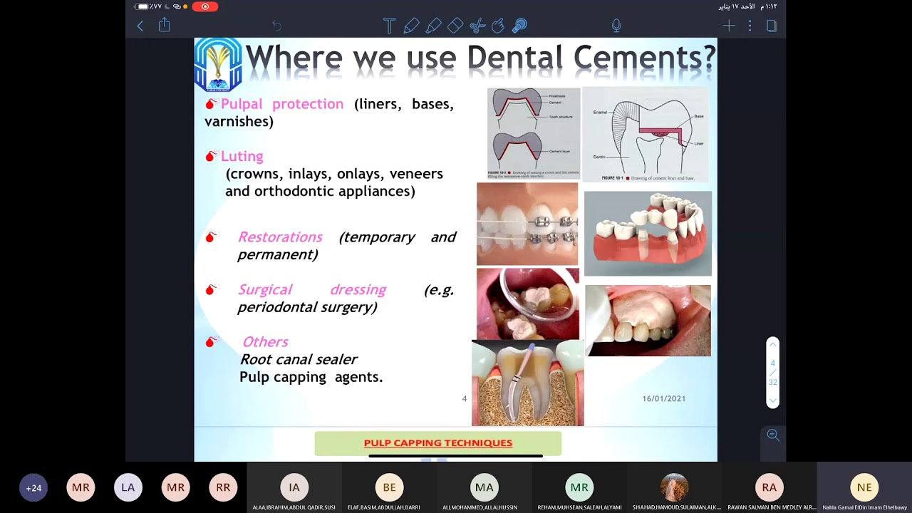 Dental Cement