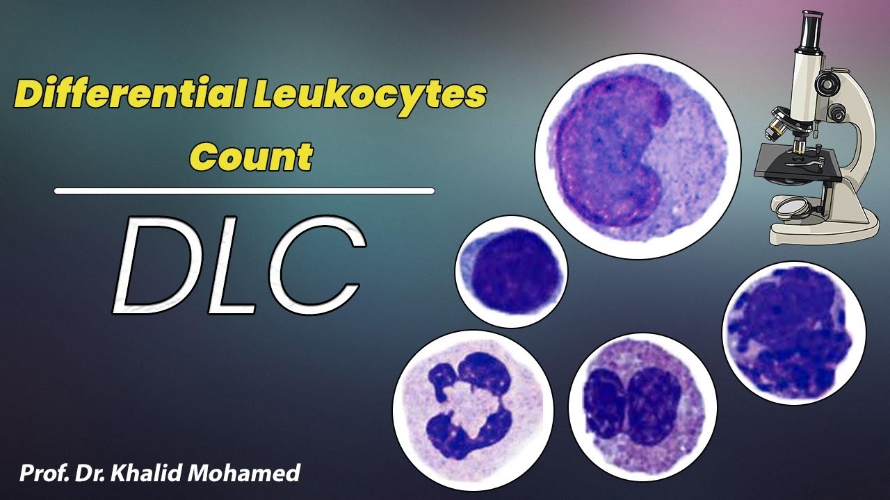 Differential leukocytes count, DLC. العد النوعي لخلايا الدم البيضاء