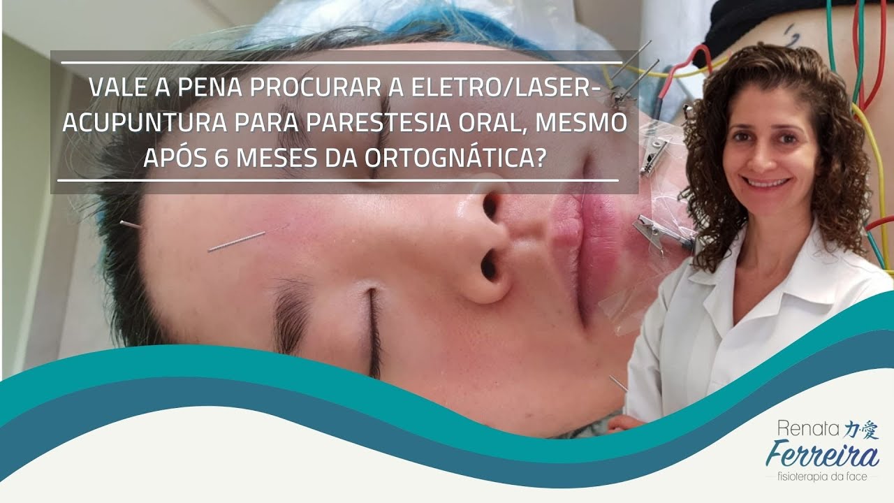 VALE A PENA PROCURAR A ELETRO/LASER-ACUPUNTURA PARA PARESTESIA ORAL AP&Oacute;S 6 MESES DA ORTOGN&Aacute;TICA?