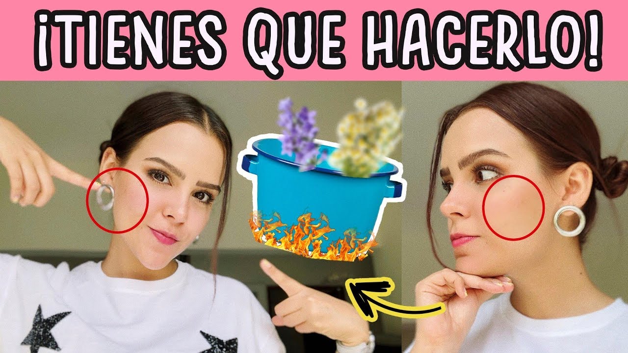 ¡ESTO ME CAMBIÓ LA PIEL Y FUE MUY FÁCIL! ♥ - Yuya