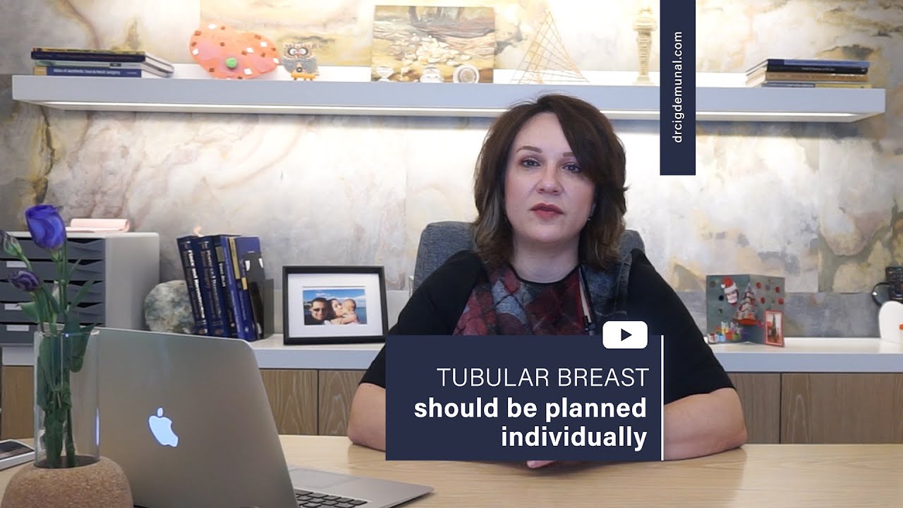 Tubular Breast Should be Planned Individually