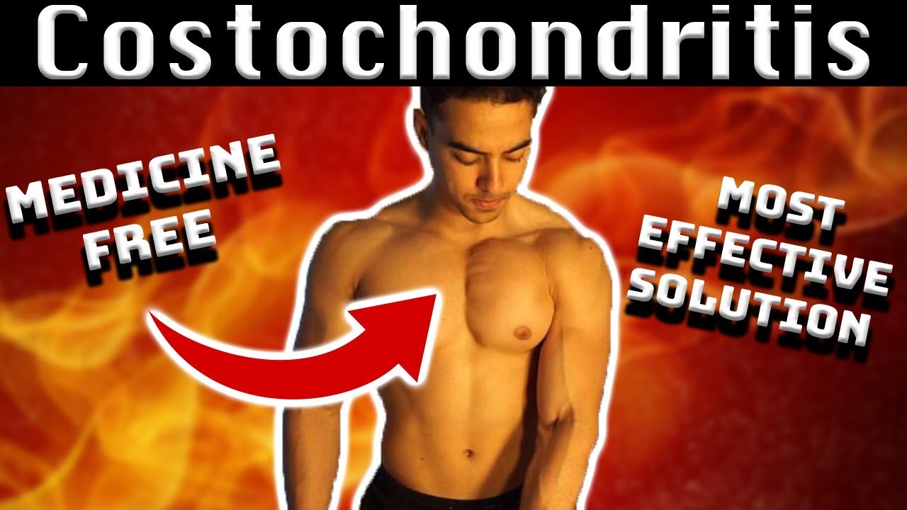 Costochondritis and Bodybuilding - My 7 year experience of handling this chest injury!