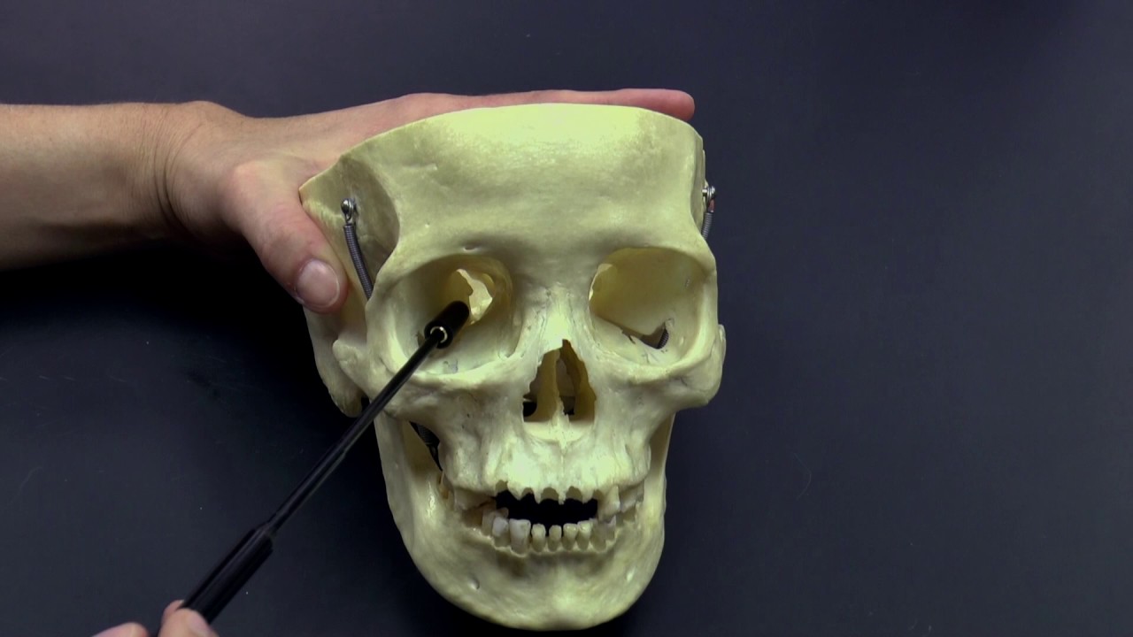 Skull Eye