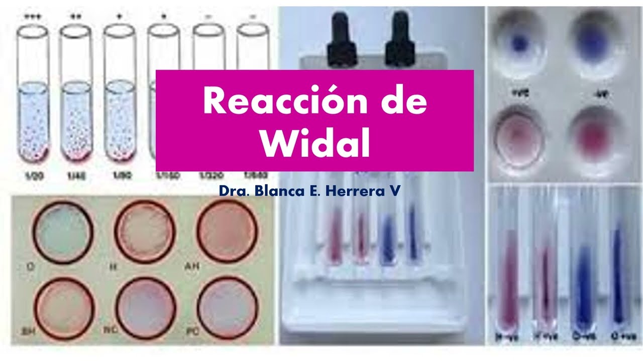 Reacción de Widal