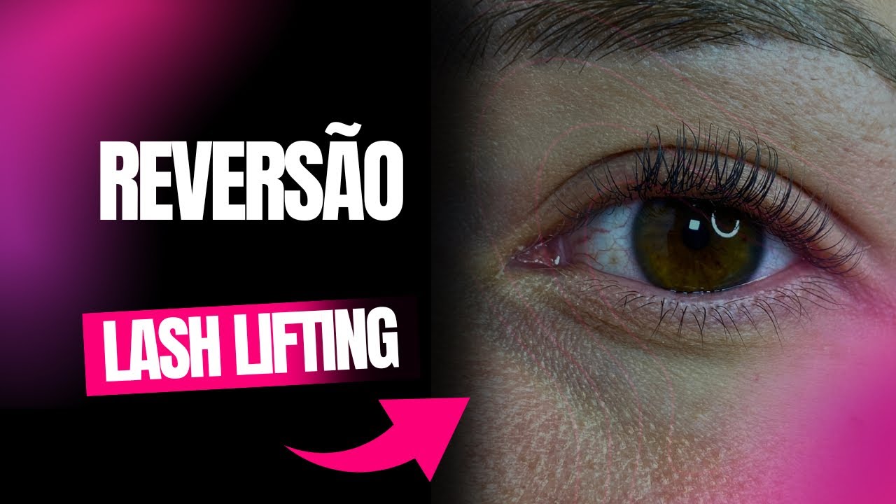 Reversão no LASH LIFTING