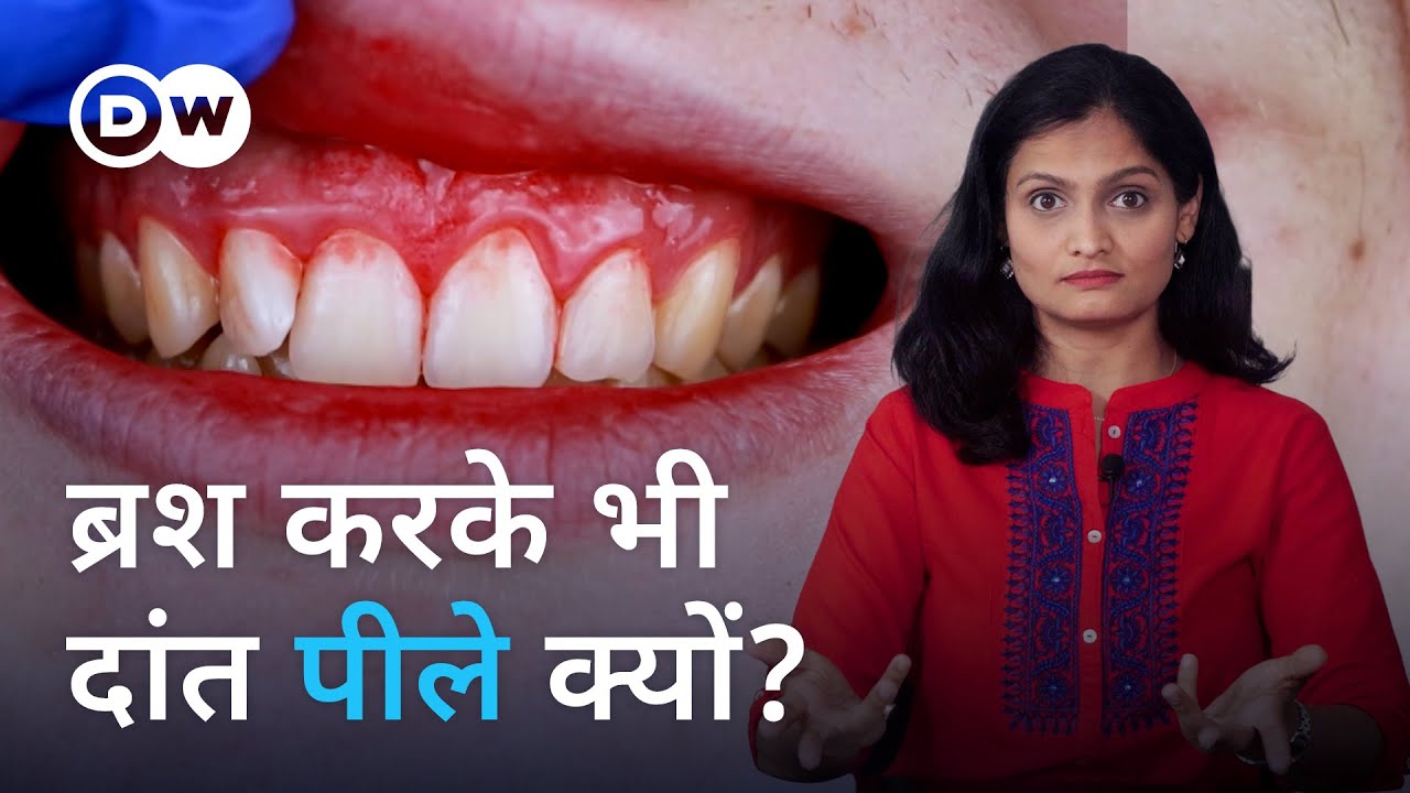 शेर नहीं करता, हम क्यों करें? [Why you should not ignore your teeth] | Sehat Talk with Keerti Bhatt