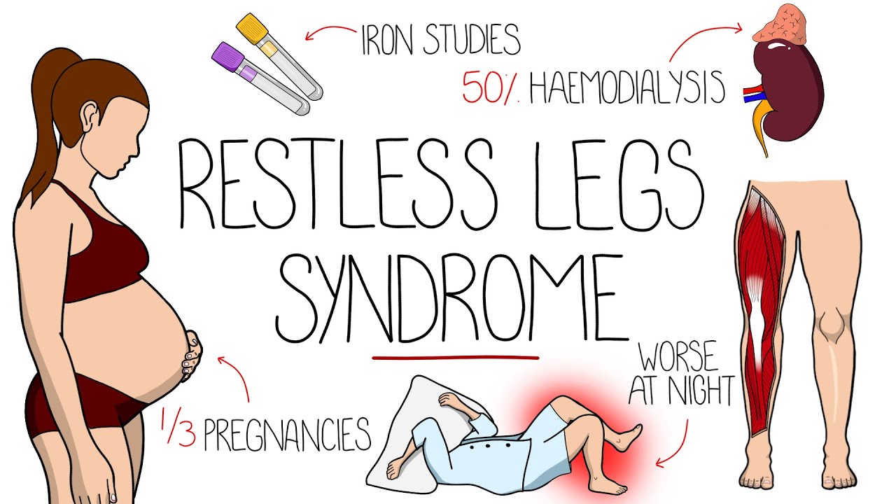 Restless Legs Syndrome Explained (Willis-Ekbom Disease)
