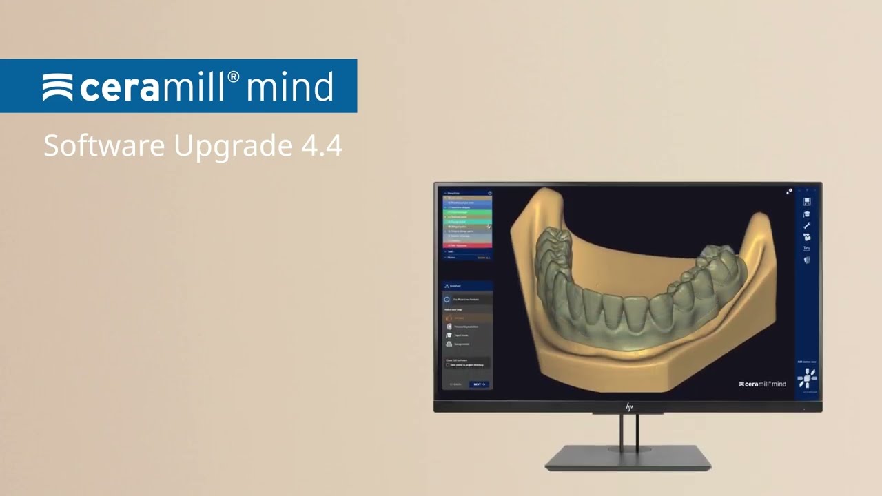Ceramill Software Upgrade 4.4 - Ceramill Mind