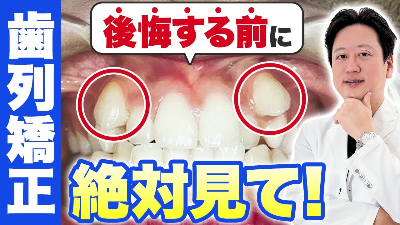 【知らないと損】ガチャ歯を治して綺麗なEラインに！矯正のゴールの決め方を教えます！【審美歯科 歯列矯正 歯並び】