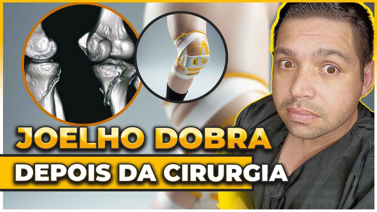 Dificuldade para Ganhar Flex&atilde;o de Joelho ap&oacute;s Cirurgia