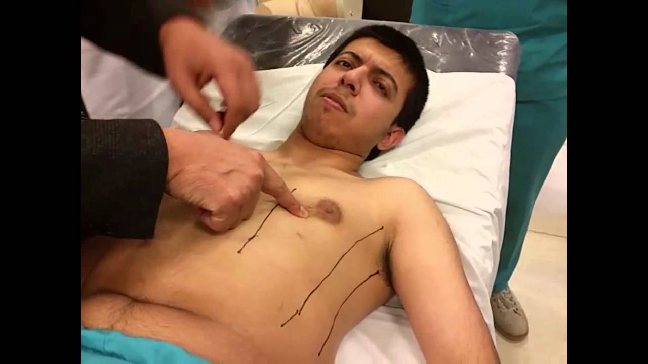 clinical skills - Abdominal Examination and Catheterization